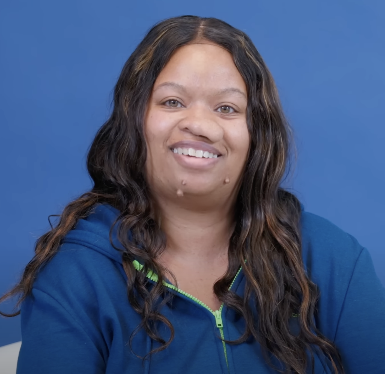 Danielle avant son opération qui a changé sa vie, datée du 2 août 2024 | Source : YouTube/@Dr.Truesdale
