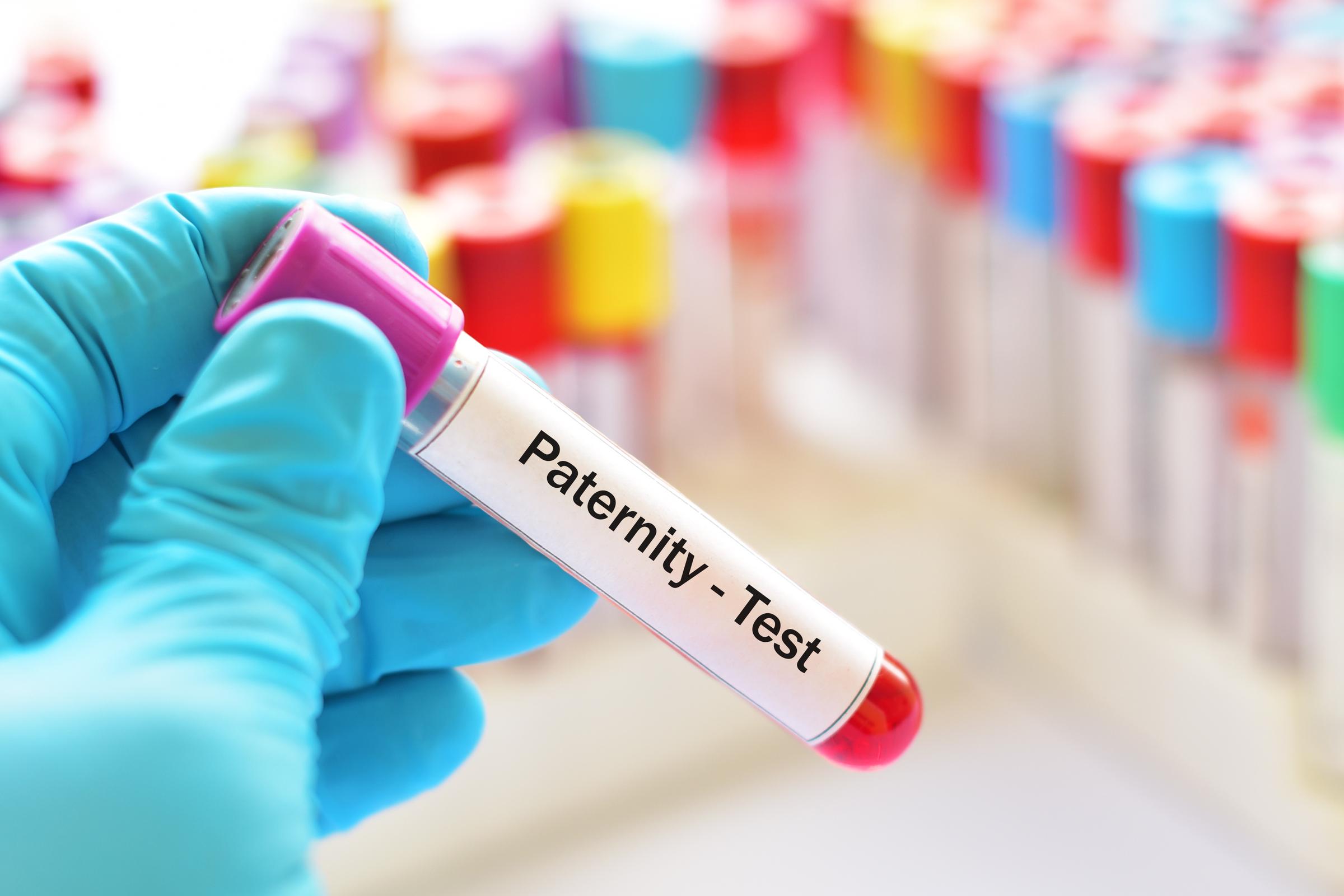 Un échantillon de sang pour un test de paternité | Source : Shutterstock