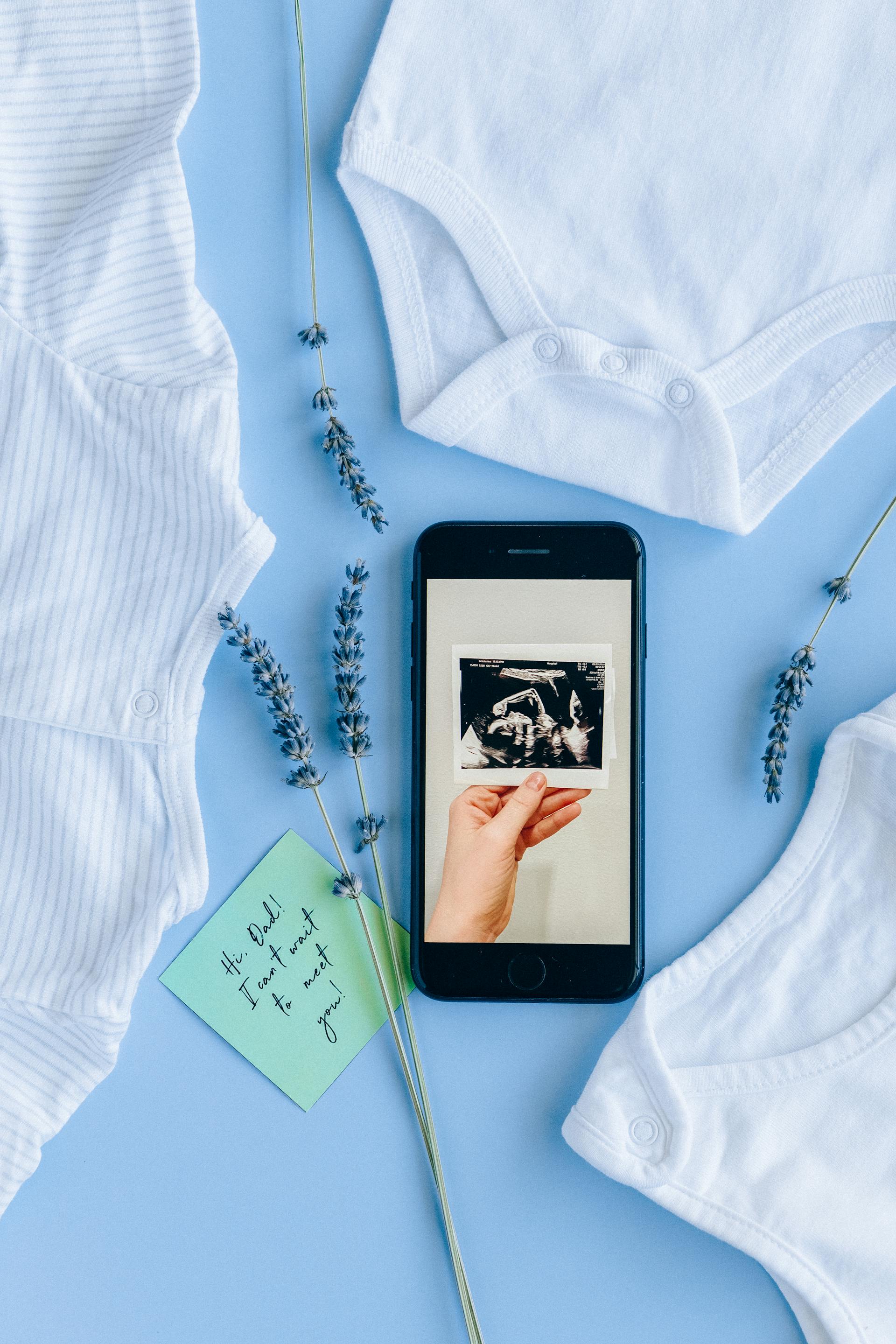 Une échographie sur l'écran d'un téléphone à côté de vêtements de bébé | Source : Pexels