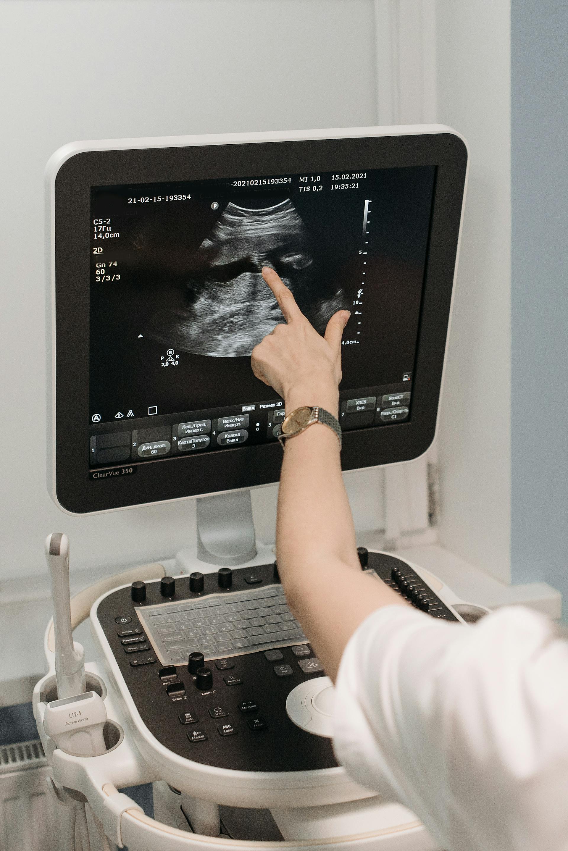 Un échographiste touche l'écran d'échographie | Source : Pexels