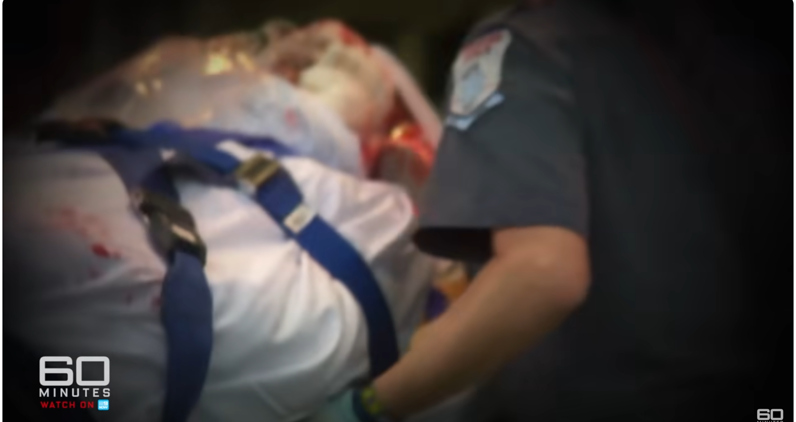 Charla Nash est à peine vivante alors qu'elle est transportée dans une ambulance après que Travis l'a attaquée, en date du 11 juin 2025 | Source : YouTube/60MinutesAustralia