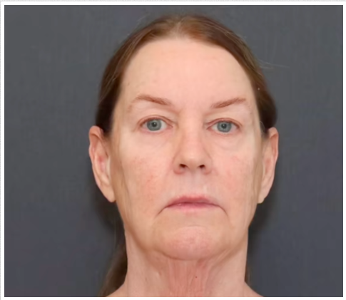 Tina Heaton avant de subir un rajeunissement complet du visage. | Source : TikTok/nayakplasticsurgery