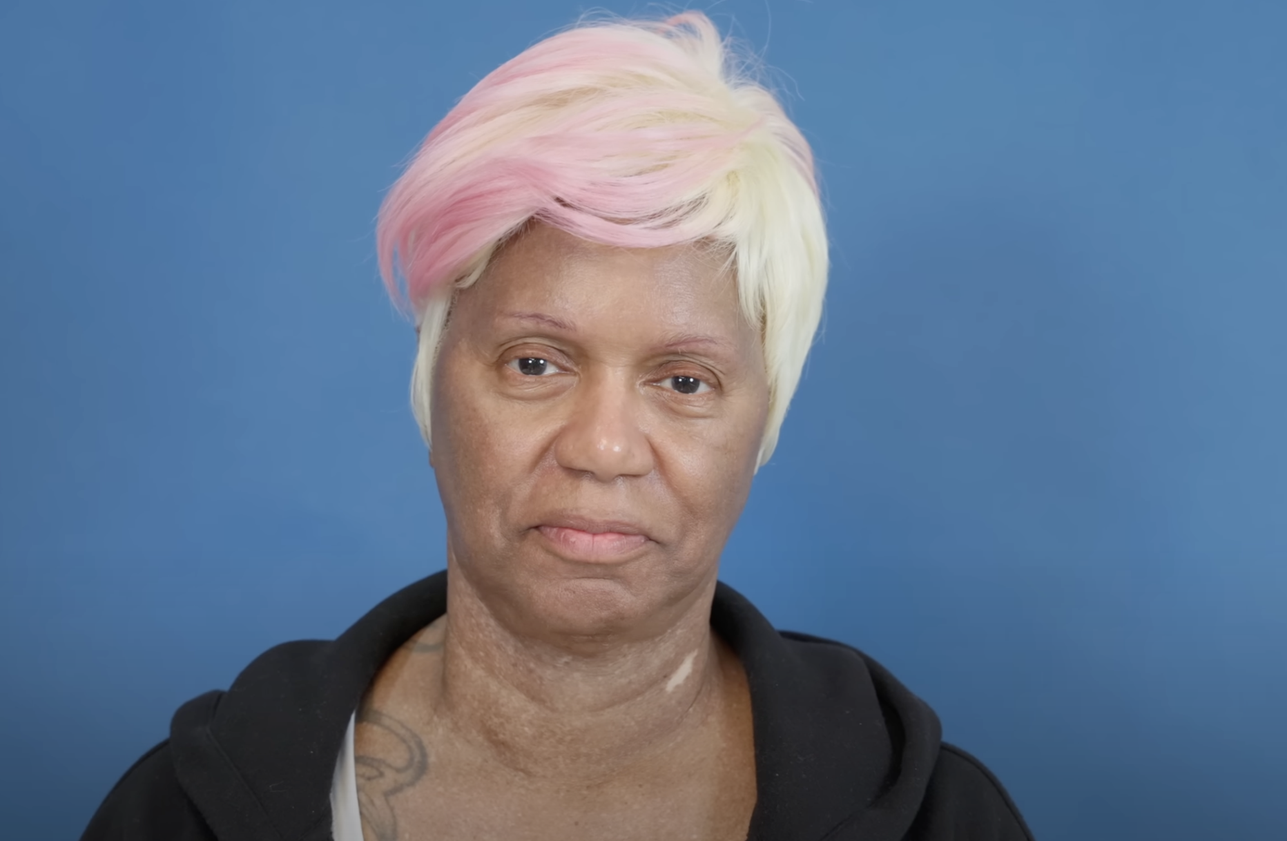 Diana avant l'opération, datée du 23 août 2024 | Source : YouTube/@Dr.Truesdale