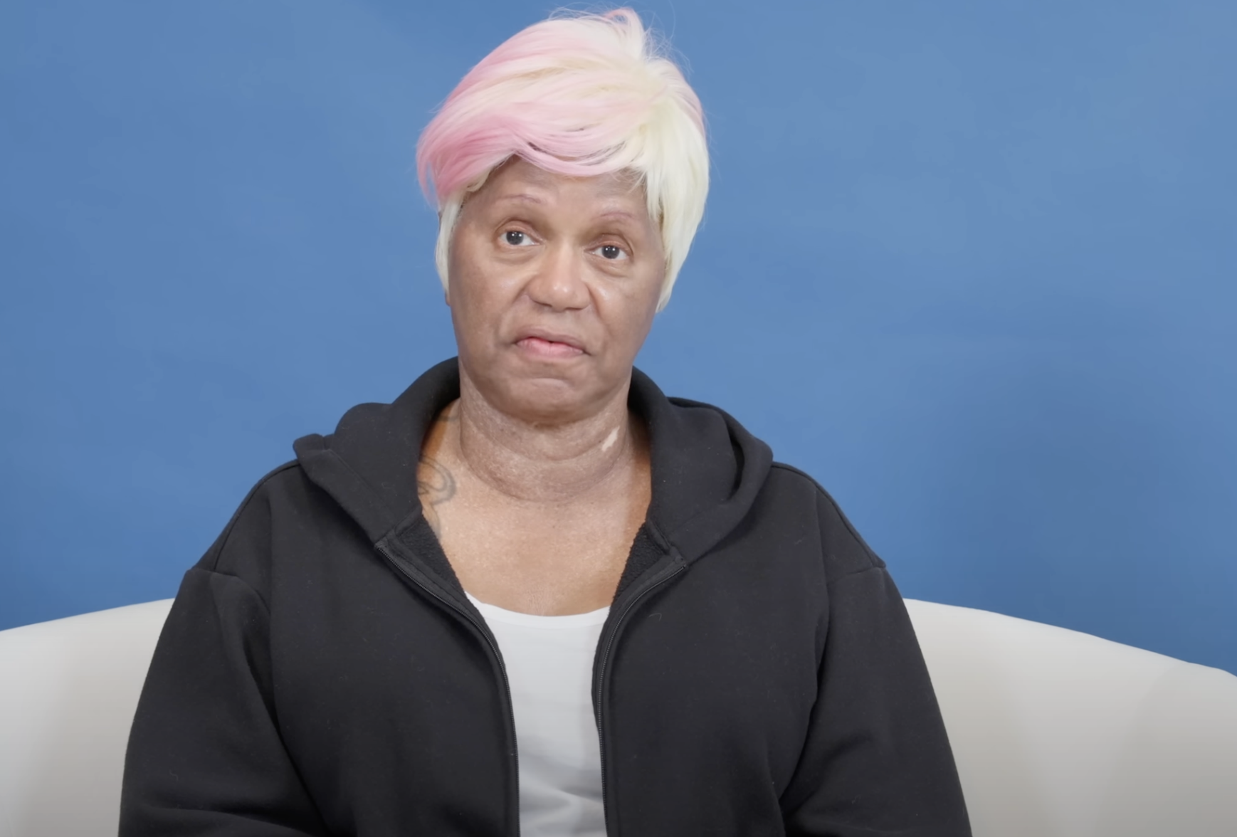 Diana avant son rajeunissement facial, daté du 23 août 2024 | Source : YouTube/@Dr.Truesdale