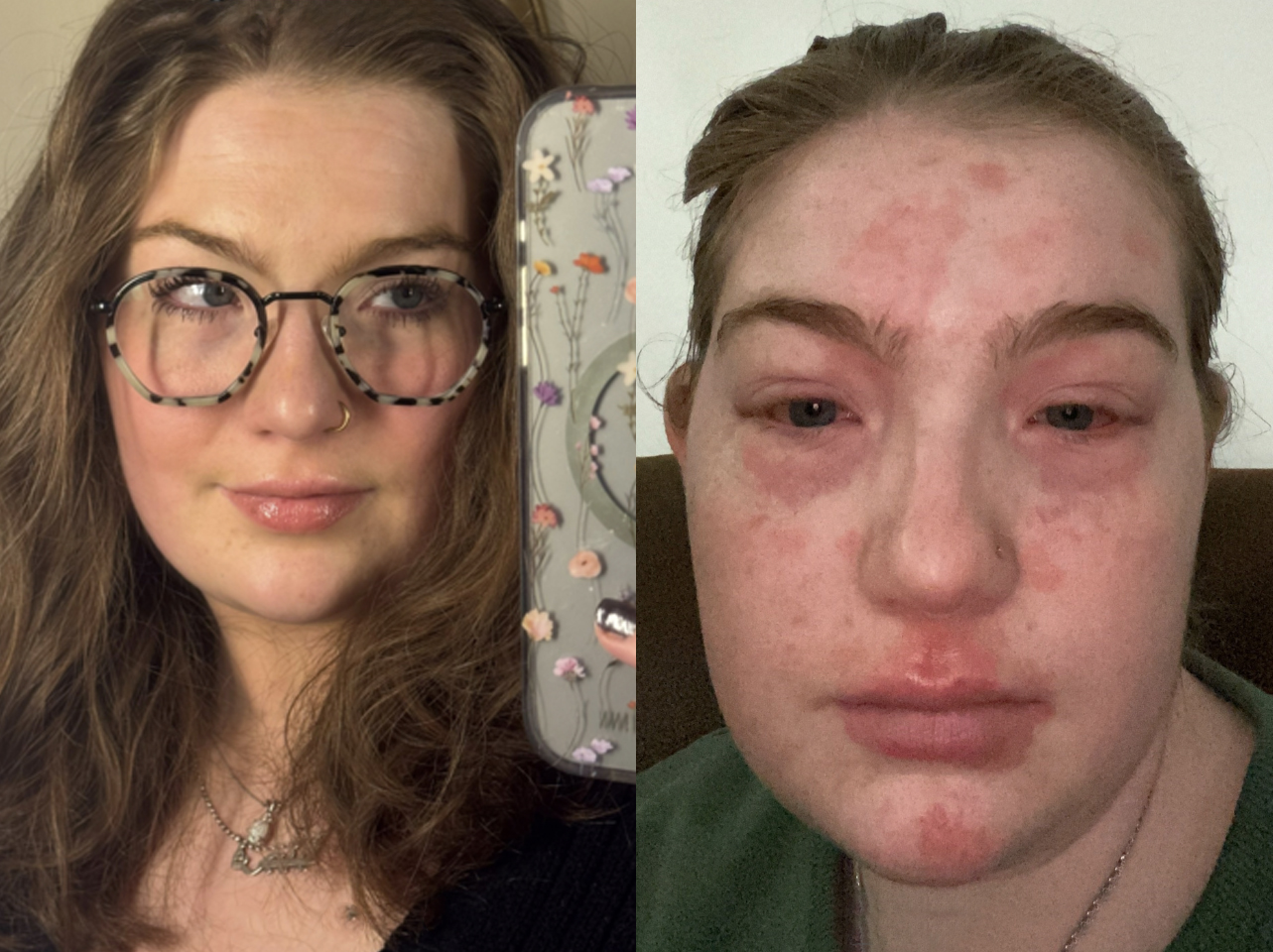 Photos avant et après d'une TikTokeuse : célibataire ou en couple. | Source : TikTok/virginiaginger00