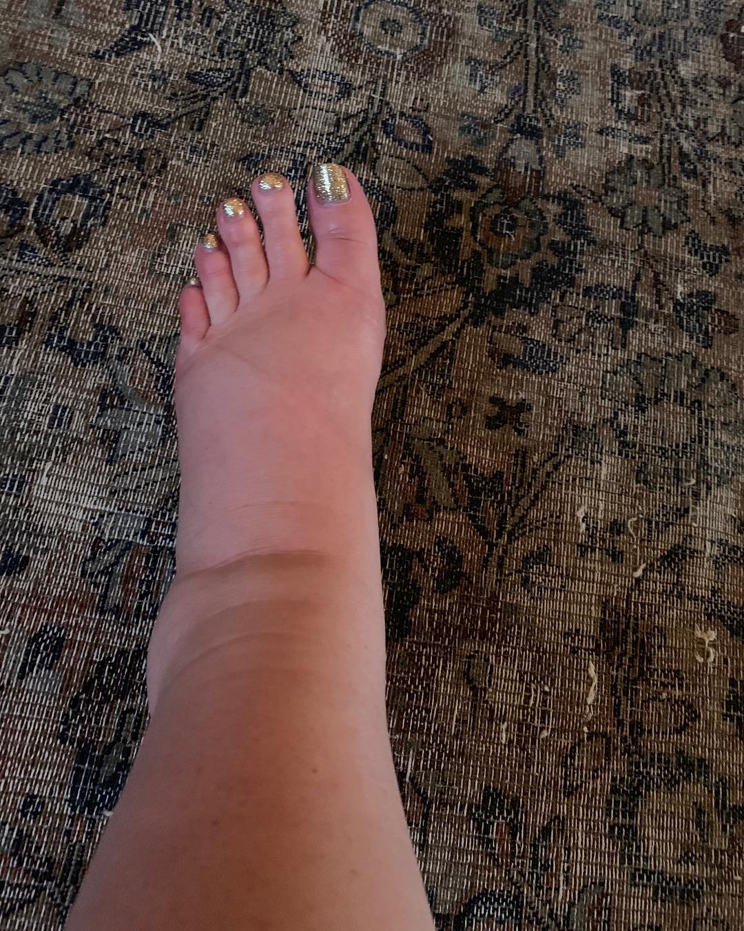 Le pied enflé de Jessica Simpson dans un post daté du 11 janvier 2019 | Source : Instagram/jessicasimpson