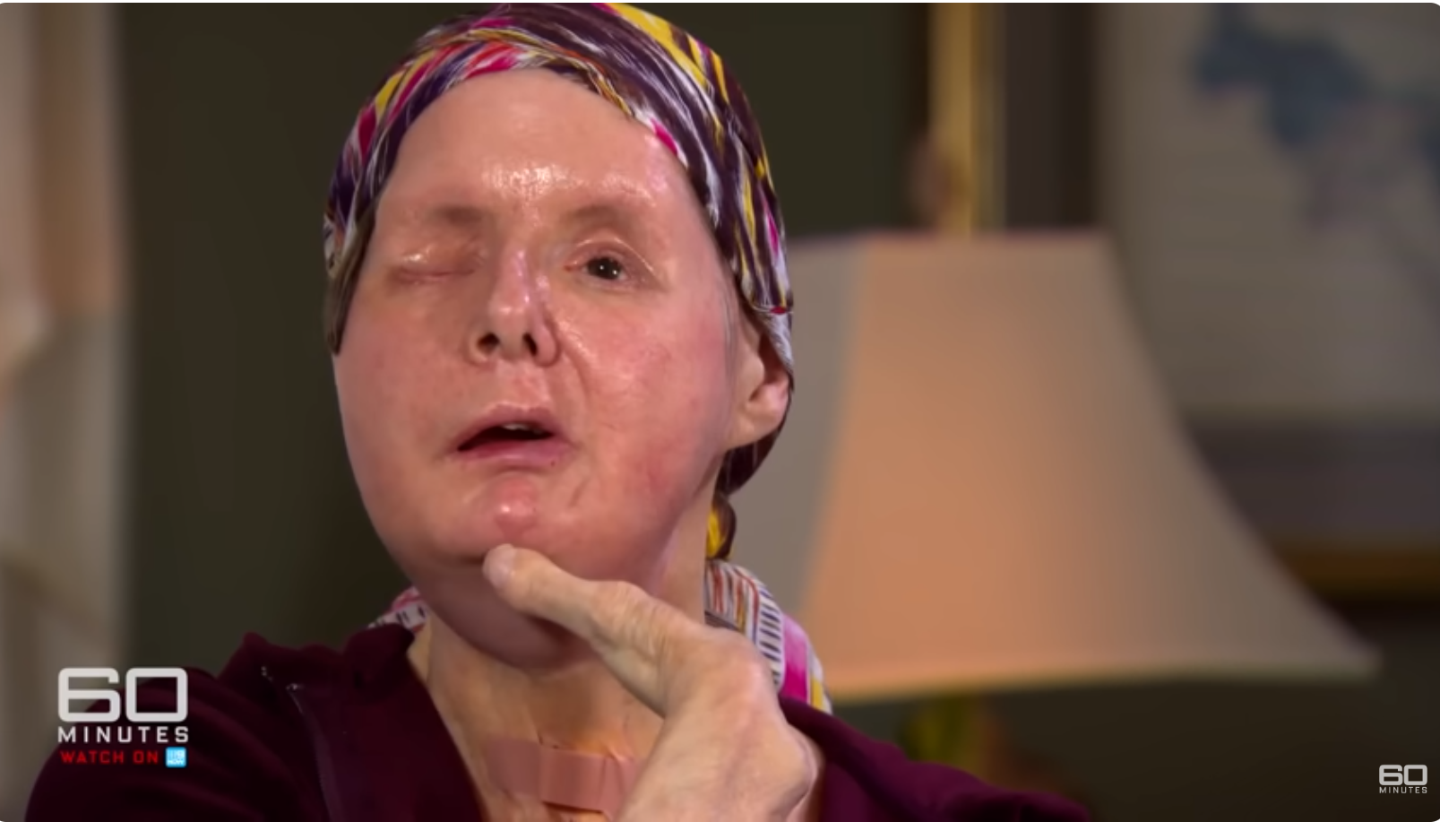 Charla Nash exprimant sa gratitude lors de son interview avec 60 Minutes Australia, datée du 11 juin 2025 | Source : YouTube/60MinutesAustralia