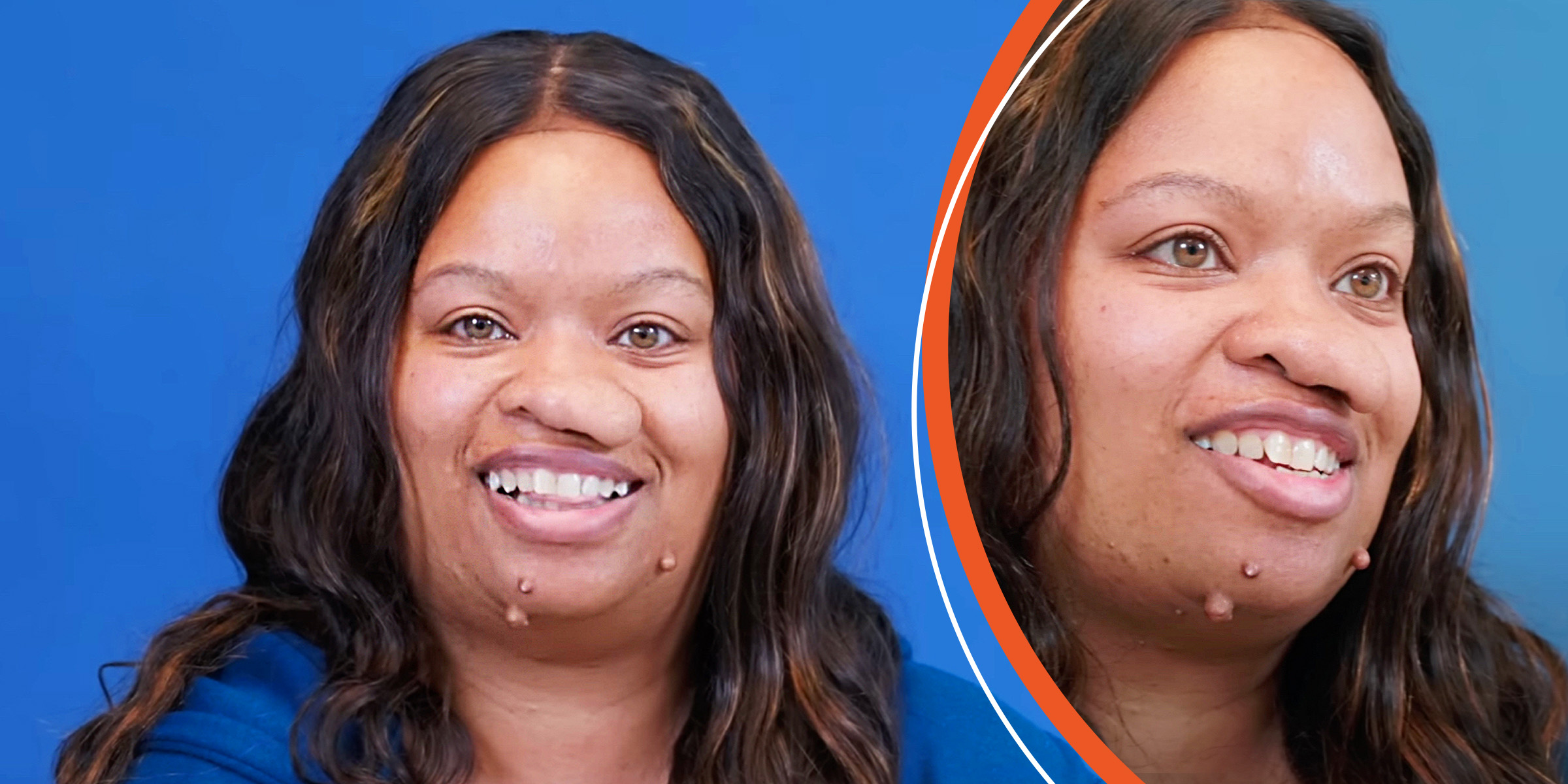 La femme atteinte de tumeurs faciales | Source : YouTube/@Dr.Truesdale