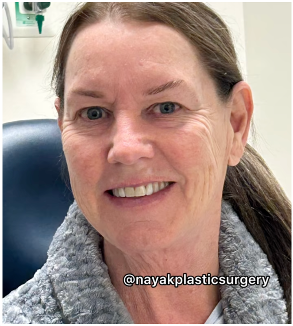 Tina Heaton souriante avant de subir une opération de rajeunissement du visage. | Source : TikTok/nayakplasticsurgery