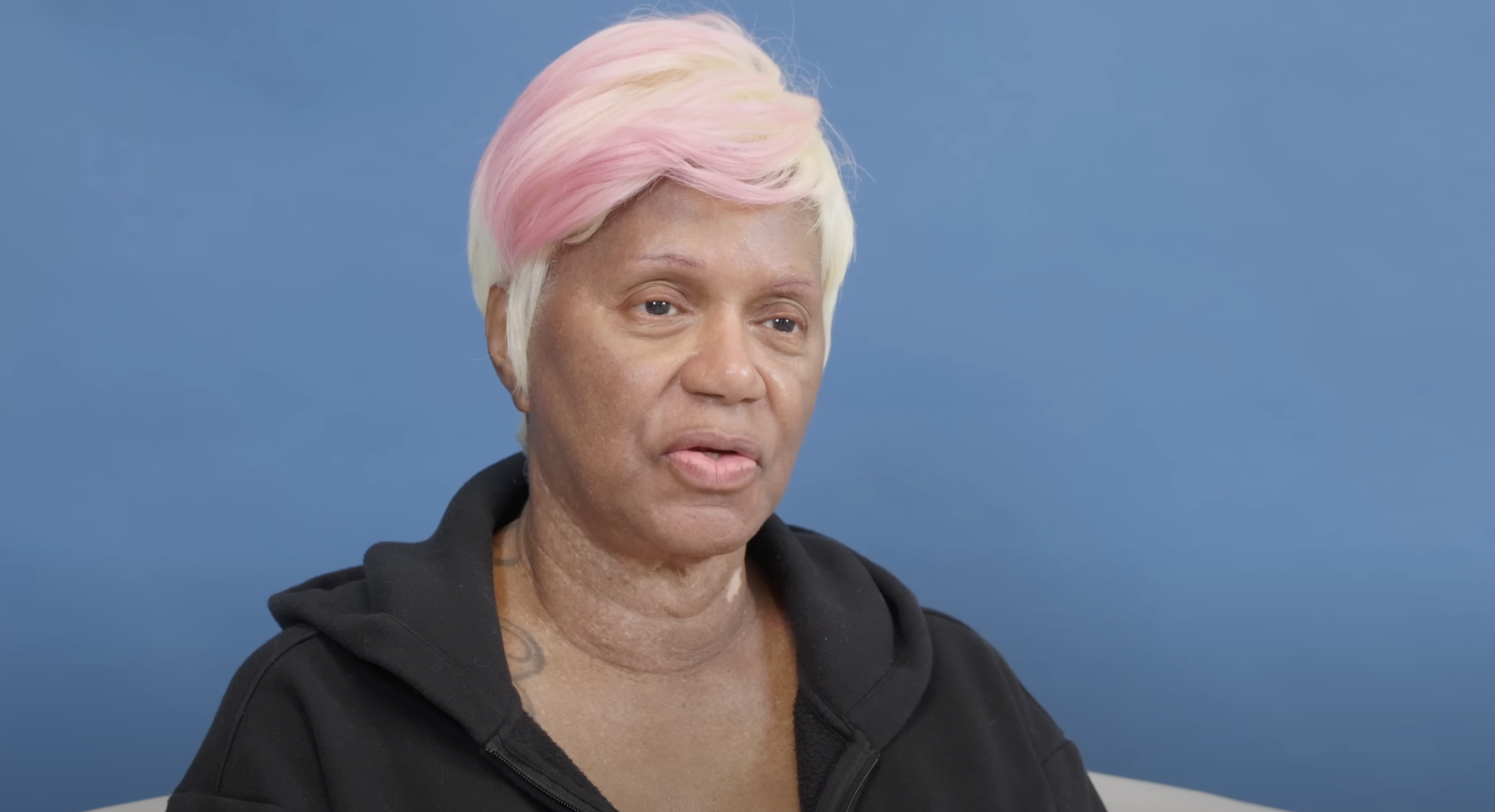 Diana vue avant l'opération, datée du 23 août 2024 | Source : YouTube/@Dr.Truesdale