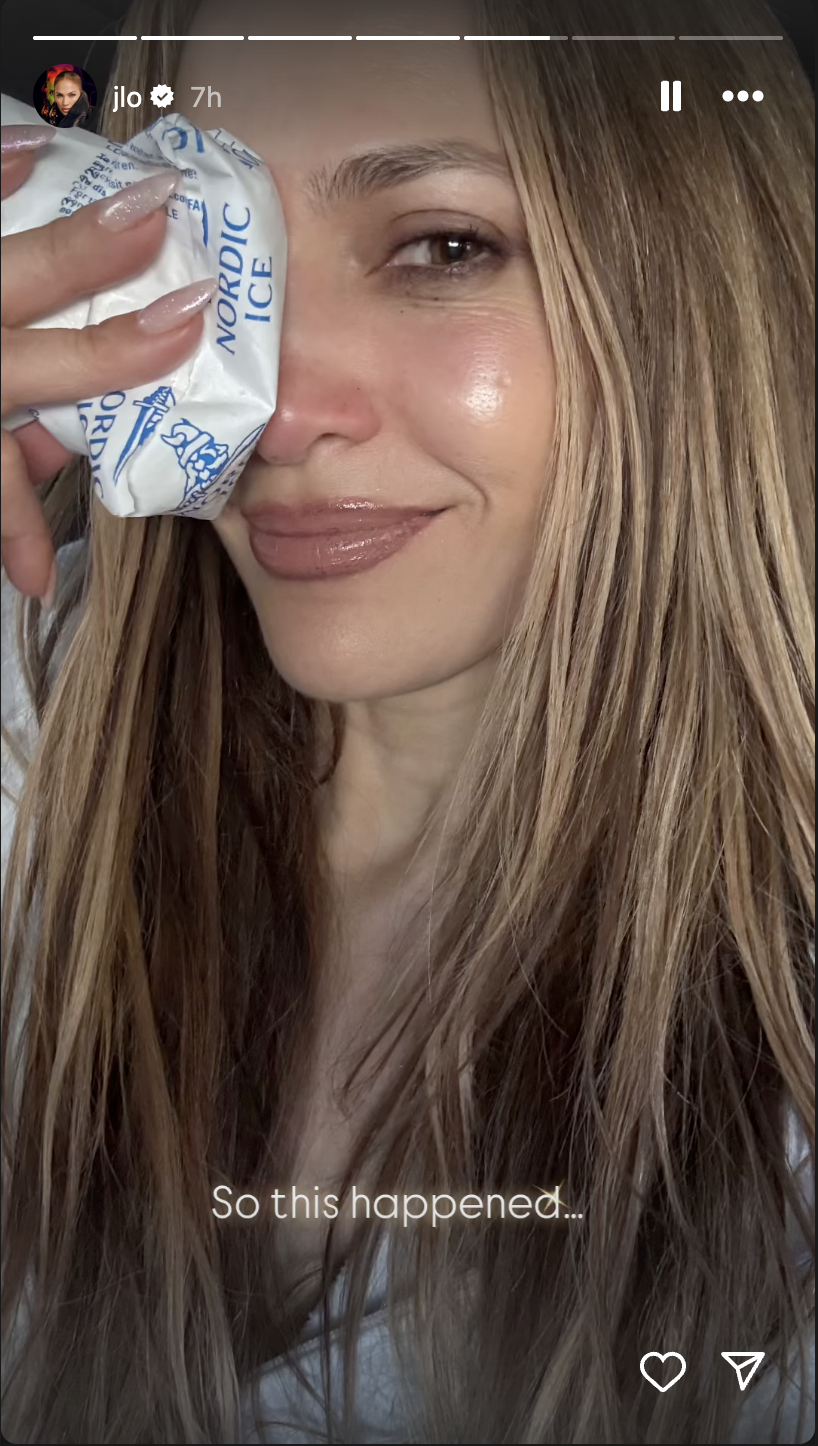 Jennifer Lopez en train de se glacer le nez, posté sur ses stories Instagram le 13 mai 2025 | Source : Instagram/jlo